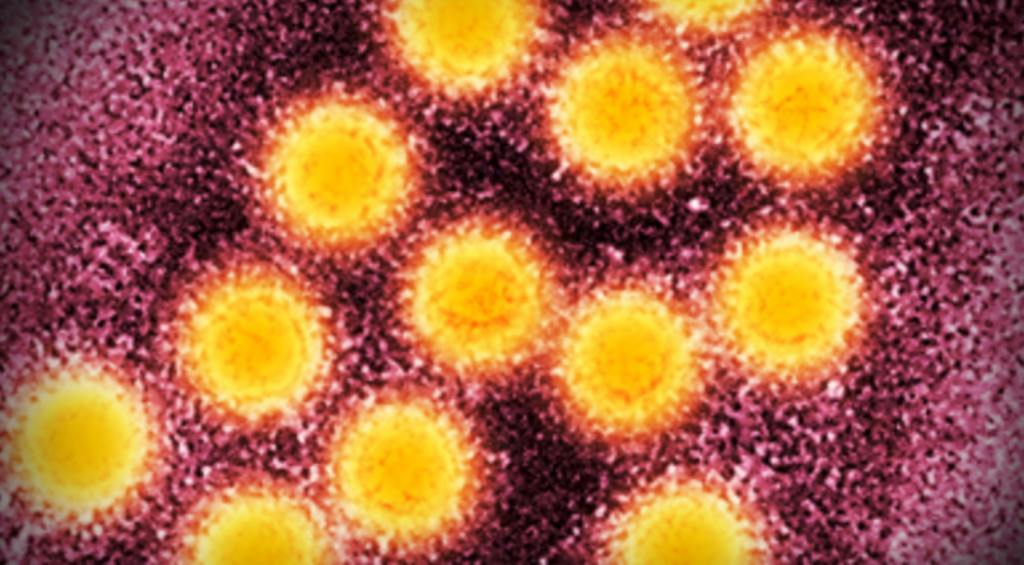 Hepatito A virusas