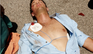 Prilipinkite elektrodus